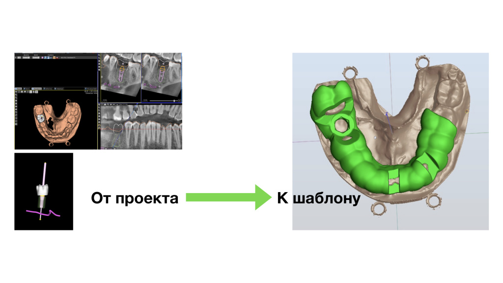 От проекта к шаблону. – Primed